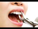 صدى البلد | حكم خلع الاسنان في نهار رمضان