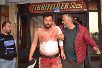 Sevgilisi Köpeğini Alıp Terk Edince İntihara Kalkıştı