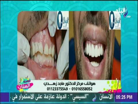 ست الستات - الخطة العلاجية الصحيحة في طب الأسنان