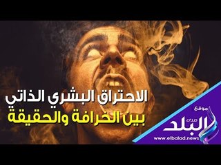 صدي البلد | الاحتراق البشري الذاتي .. بين الخرافة والحقيقة