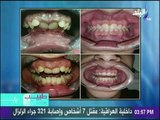 اسباب اعوجاج الأسنان وكيفية علاجها مع الدكتور عمر يسري