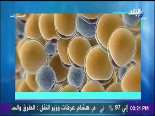 طبيب البلد - الدكتور حاتم نعمان يكشف عن طرق سحرية لعلاج السمنة نهائيا