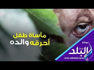 صدى البلد |  مأساة طفل أحرقة والده