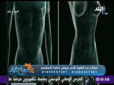 شاهد.. كيف تتم عملية شفط الدهون - د.أشرف سمعان | صباح البلد