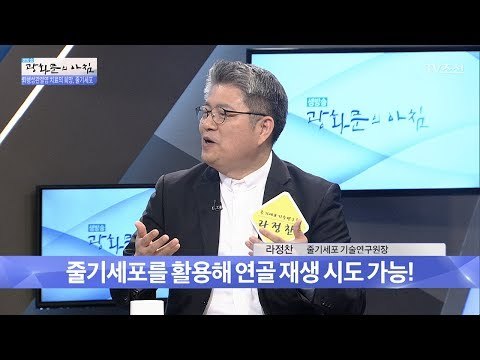 줄기세포가 피부를 바꿔준다?! [광화문의 아침] 494회 20170602
