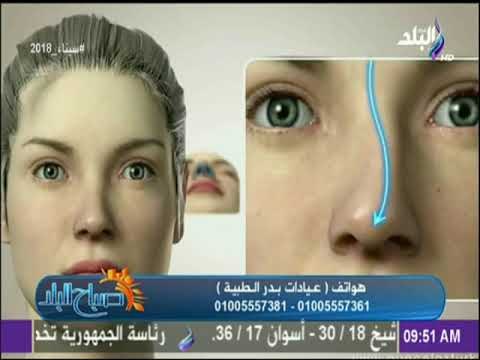 صباح البلد - هكذا تتم عملية تجميل الانف .. د.أشرف سمعان