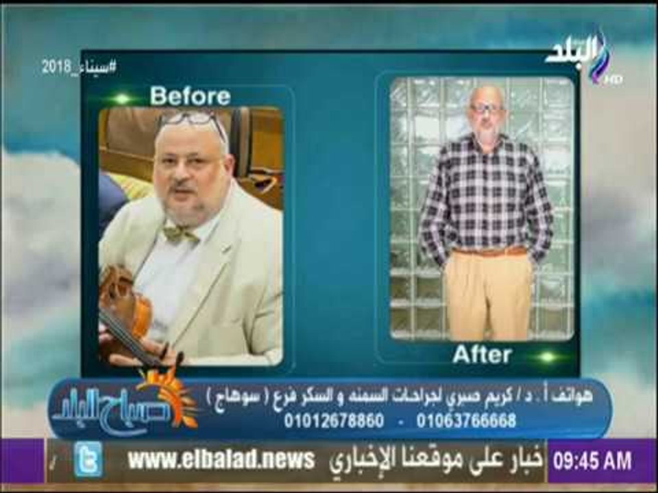 صباح البلد - تعرف علي أحدث طرق انقاص الوزن مع الدكتور كريم صبري