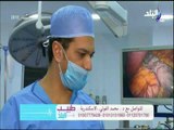 شاهد.. عملية تكميم المعدة  من داخل غرفة العمليات - د.محمد الفولي | طبيب البلد