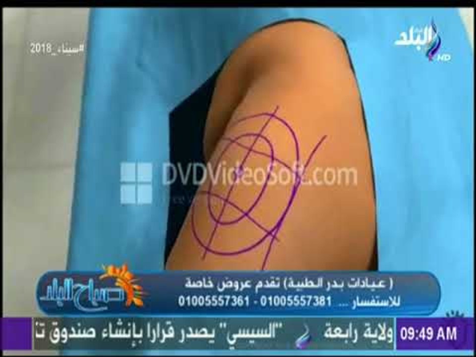 صباح البلد - أحدث تقنيات فى مجال التجميل مع الدكتور أشرف سمعان