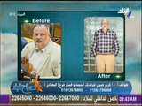 صباح البلد - عملية تحويل مسار المعدة وكيف تساعد فى الشفاء من مرض السكري