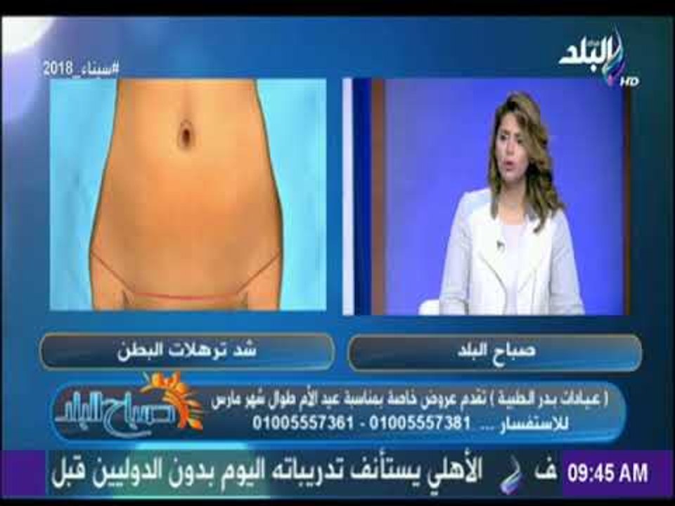 صباح البلد - تعرف على عملية شفط دهون البطن - الفوائد والمخاطر - د.أشرف سمعان