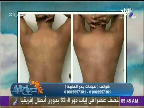 صباح البلد - عمليات نحت و تنسيق القوام وانواعها - د.أشرف سمعان