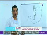 طبيب البلد - د. محمد الفولي يحذر من عملية الفراشة.. ويوضح الفرق بينها وبين تكميم المعدة