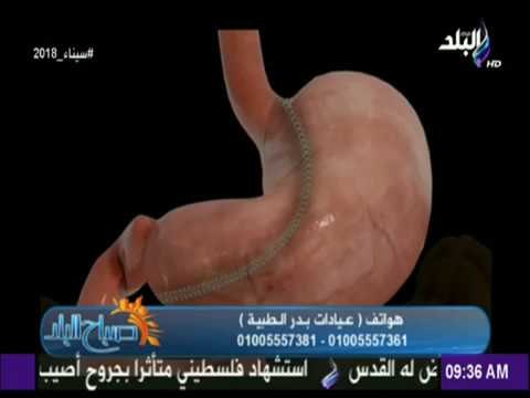 صباح البلد - الفرق بين عمليات تكميم المعدة و بلون المعدة وتحويل المسار مع الدكتور أشرف سمعان
