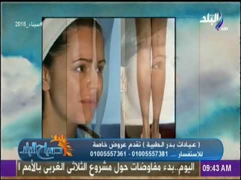 صباح البلد - الجديد فى عمليات شفط الدهون مع الدكتور أشرف سمعان