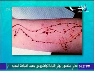 ست الستات - كيف تواجه الأسرة خطر لعبة الحوت الأزرق؟ مع الدكتور أحمد علام