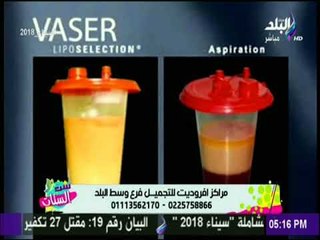 عملية النحت الذكي للجسم - د. أشرف كامل | ست الستات