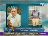 صباح البلد - السمنة المفرطة..ومخاطرها وطرق التخلص منها مع الدكتور كريم صبرى