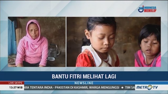 Derita Sindrom Steven Johnson, Fitri Terpaksa Putus Sekolah