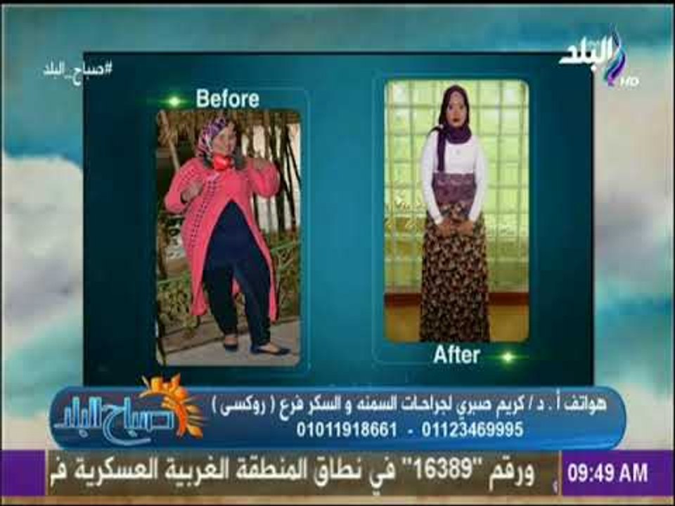 صباح البلد - عمليات شفط الدهون والجديد فى جراحات السمنة وإنقاص الوزن مع الدكتور كريم صبري