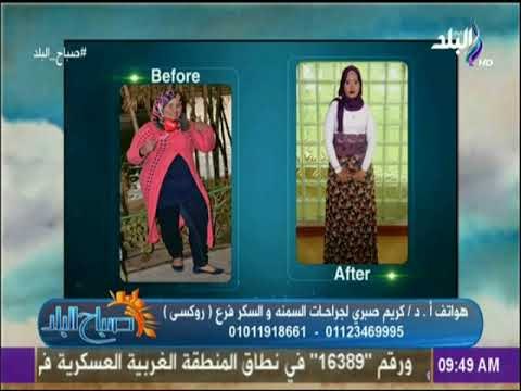 صباح البلد - عمليات شفط الدهون والجديد فى جراحات السمنة وإنقاص الوزن مع الدكتور كريم صبري