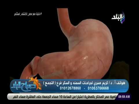 صباح البلد - أحدث طرق لعلاج السمنة مع الدكتور كريم صبرى