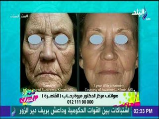 ست الستات - الليزر ... أنواعه وأهم استخداماته- د. مروة رحاب