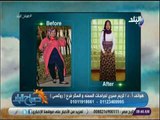 صباح البلد - الجديد فى جراحات السمنة المفرطة مع الدكتور كريم صبري