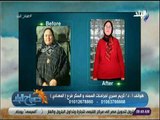 صباح البلد - تعرف علي كل ما هو جديد في عالم جرحات السمنة مع الدكتور كريم صبري