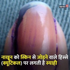 why voter ink did not remove easily