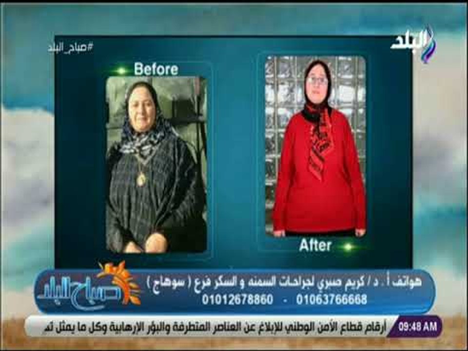 صباح البلد - أحدث طرق للتخسيس مع الدكتور كريم صبري