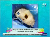 ست الستات - لو بتخاف من حشو العصب .. شاهد التقنيات الحديثة لعلاج الاسنان - د. أمجد رسلان
