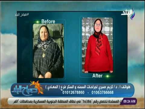صباح البلد - أحدث جراحات السمنة ونصائح التى يجب إتباعها قبل اجراء العملية مع الدكتور كريم صبري