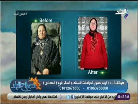 صباح البلد - الدكتور كريم صبري يشرح طريقة تنسيق القوام..وعمليات السمنة وتحويل المسار لمرضى السكر