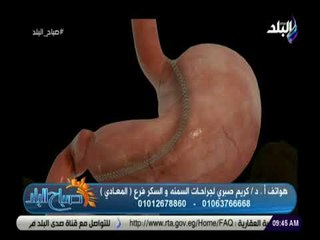 صباح البلد - كيفية الوصول للوزن المثالي  - د. كريم صبري