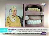 طبيب البلد - كيف تتم زراعة الأسنان بدون آلام خطوة بخطوة مع الدكتور إسراء السعيد
