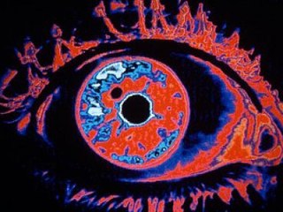 Día Mundial del Glaucoma