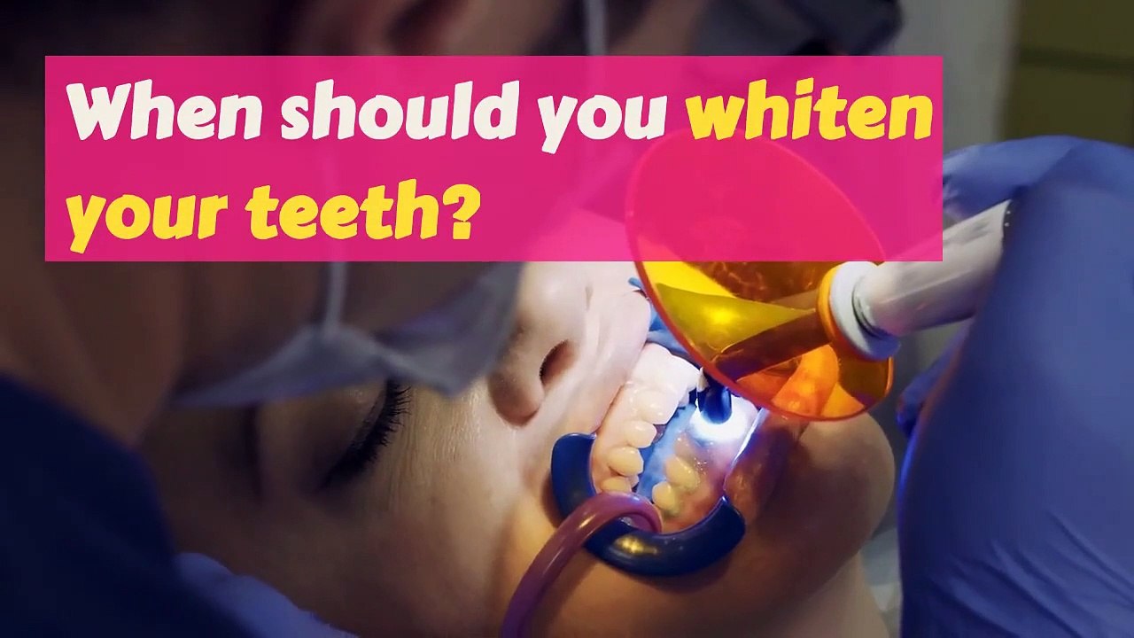 When Do You Need Teeth Whitening