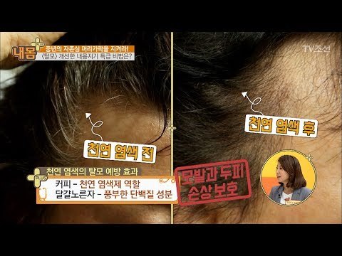 탈모를 혼자서 극복한 내몸지기의 특별한 비결?! [내 몸 플러스] 64회 20170630