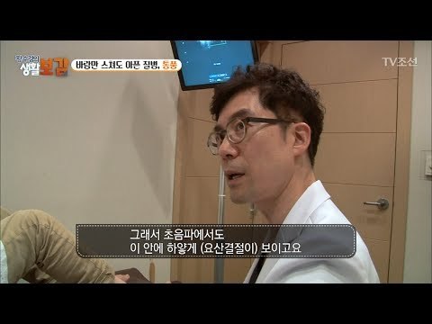 술, 고기 좋아하는 사람 주목! 통풍 조심! [황수경의 생활보감] 15회 20170715