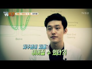 치주염이 치매까지 유발한다?! [황수경의 생활보감] 16회 20170722