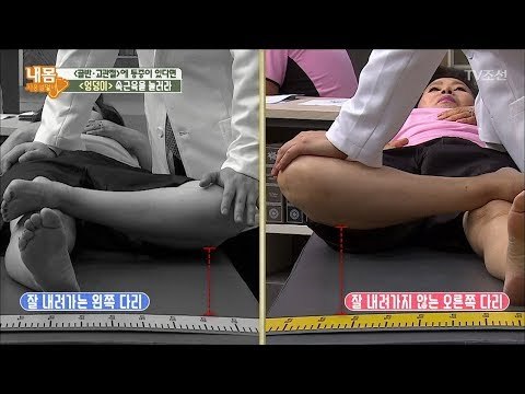 골반, 고관절 통증에는 엉덩이를 눌러라! [내 몸 사용설명서] 164회 20170804