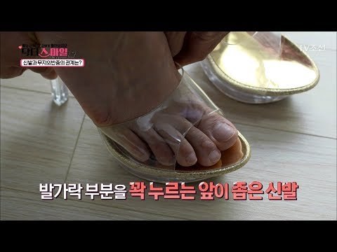 하이힐을 신는다고 꼭 ‘무지외반증’이 오는 건 아니다?! [닥터 스마일] 7회 20170815