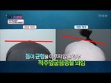 척추옆굽음증 자가 진단하는 방법은? [닥터 스마일] 6회 20170808