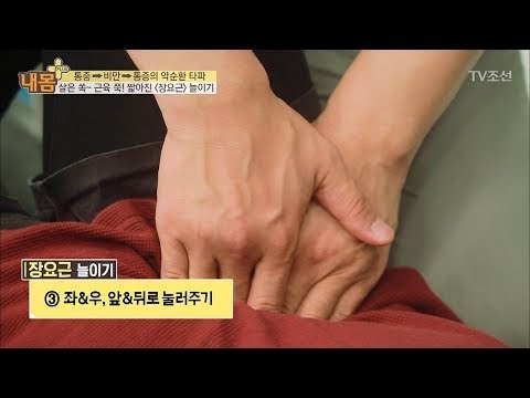비만으로 인한 통증 잡는 운동! [내 몸 플러스] 71회 20170827