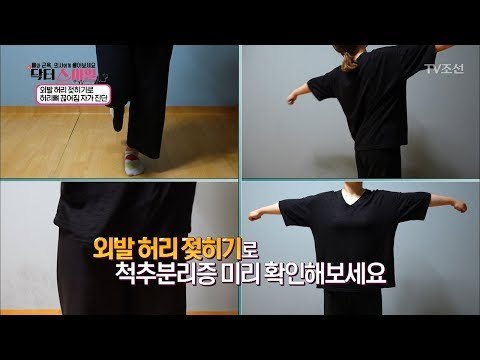 ‘어긋난 척추뼈’ 확인하는 방법은? [닥터 스마일] 9회 20170829