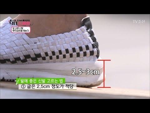 무지외반증 피하는 신발 고르는 팁! [닥터 스마일] 7회 20170815