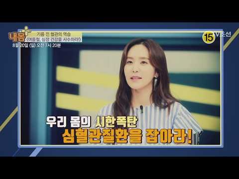 여름철, 심장 건강을 사수하라!_내 몸 플러스 70회 예고