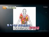 침묵의 살인자, 잠복염증! 만병의 씨앗인 이유? [내 몸 사용설명서] 166회 20170818