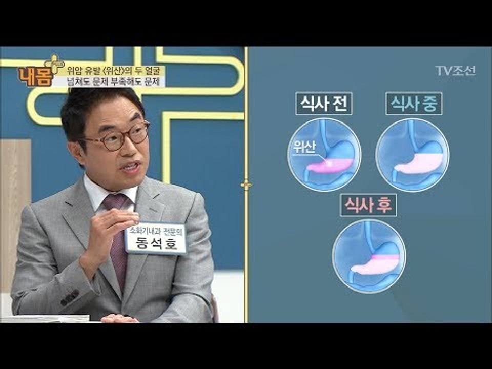 위산, 넘쳐도 문제 적어도 문제! [내 몸 플러스] 75회 20170924